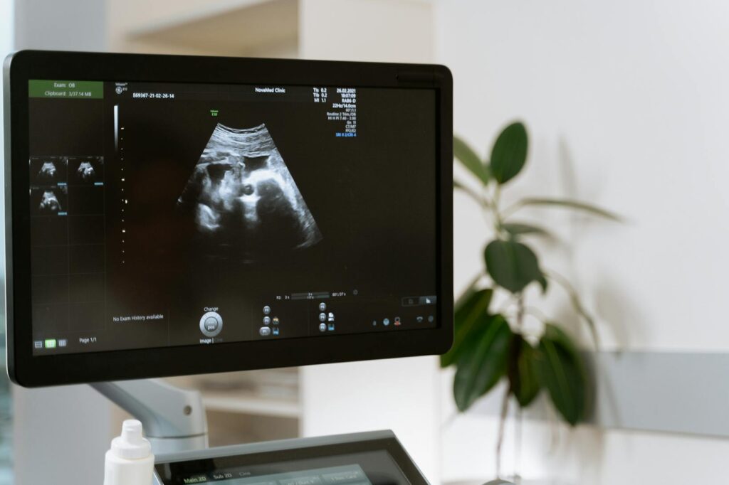 emerging trends in ultrasound imaging